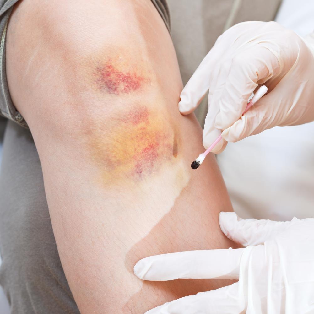 The Screening Process at Indigo Dermatology