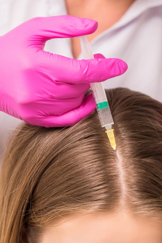 How Does Stem Cell Therapy For Hair Loss Work?