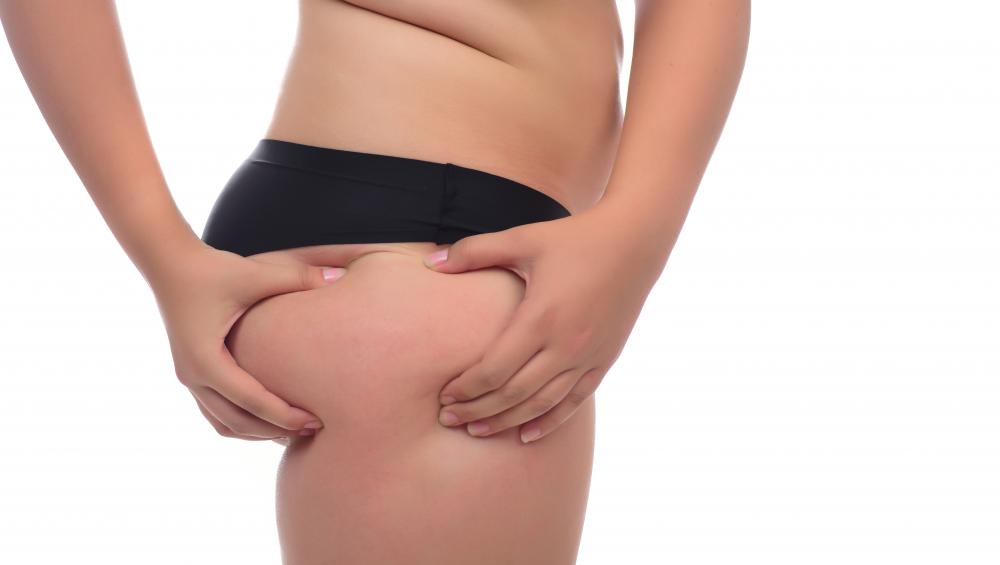 Why Choose Premier Liposuction for Your Procedure
