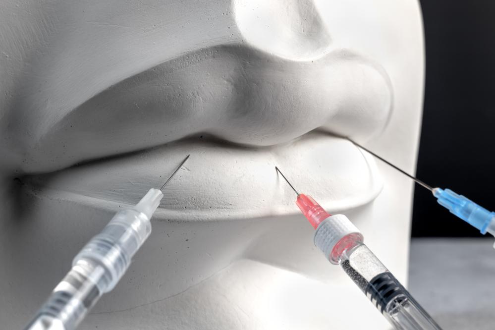 Who Can Benefit from Botox Lip Injections?