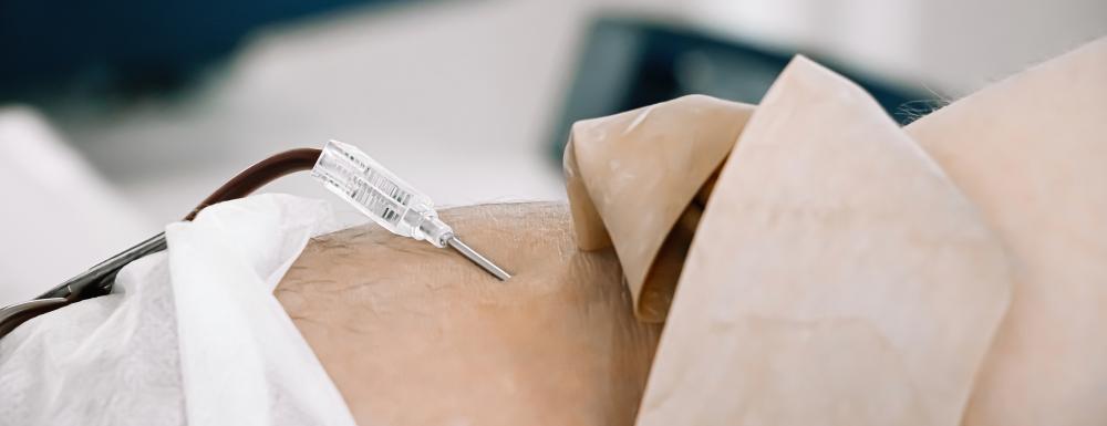 Experience with Stem Cell Injections