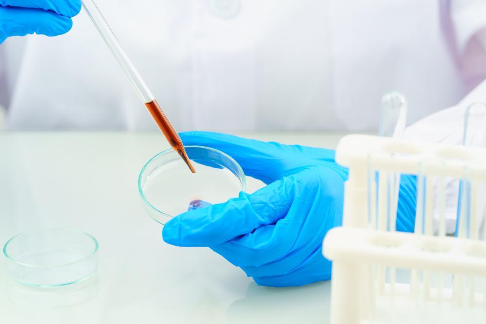 Factors Affecting Stem Cell Therapy Cost Miami