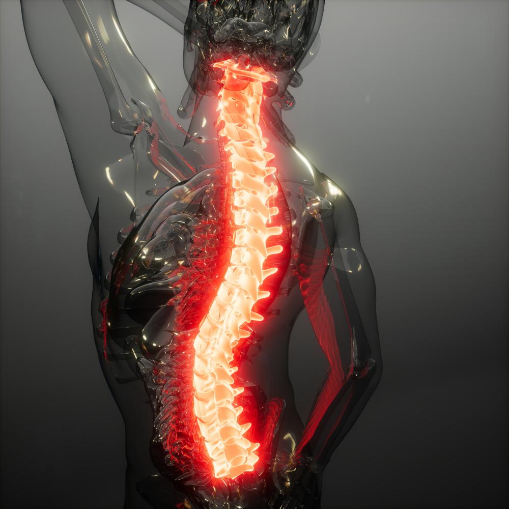 What Can Patients Expect From Stem Cell Therapy For Spinal Cord Injury?