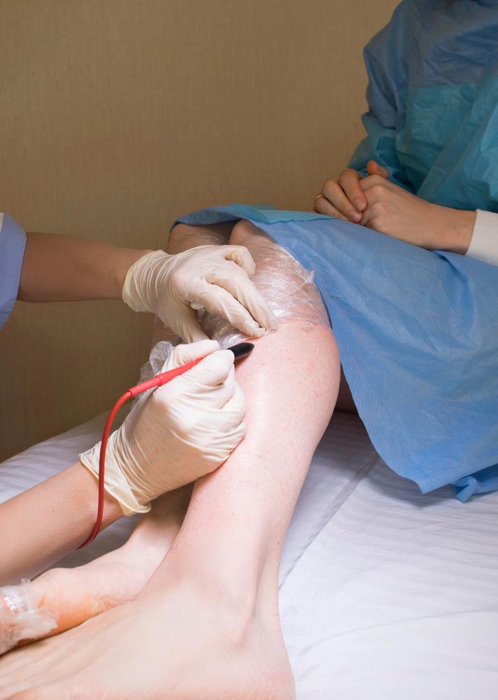 Benefits of Palm Beach Stem Cell Therapy For Knees