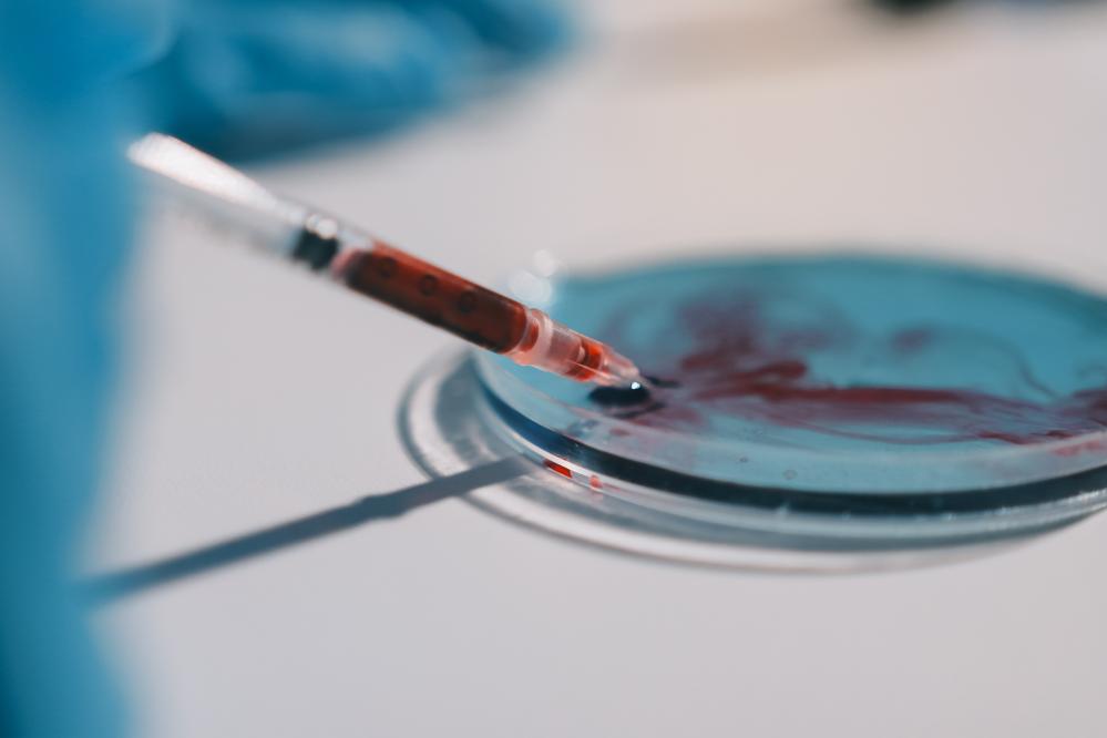 What Makes Stem Cell Injections Effective?