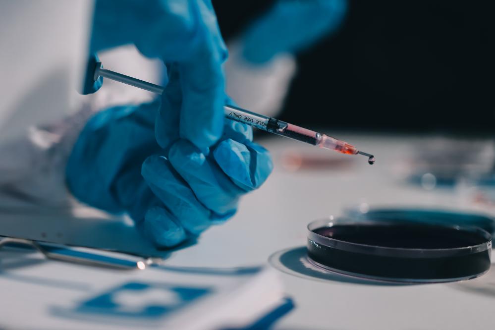 Is Insurance an Option for Stem Cell Injections?