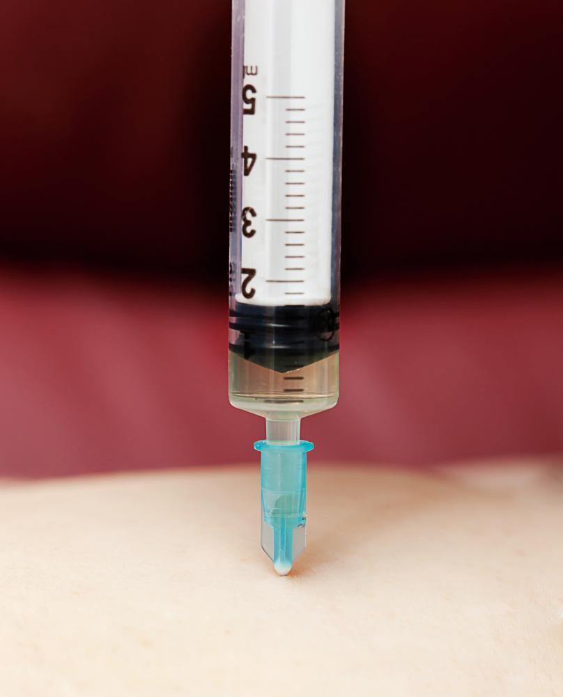 Why Consider Wharton's Jelly Injection Cost?