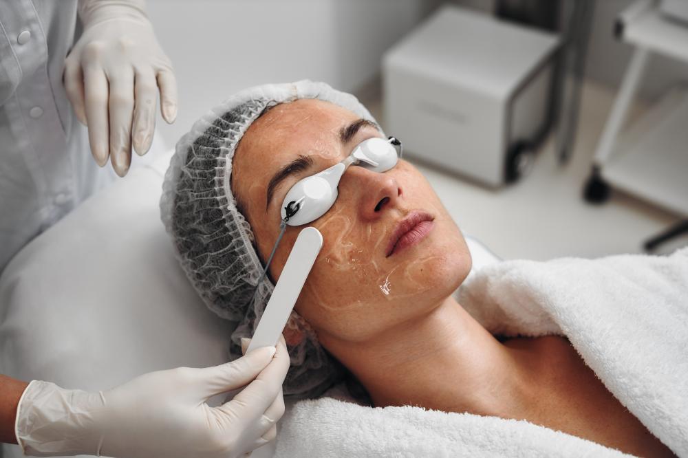 SilkPeel Treatment Options