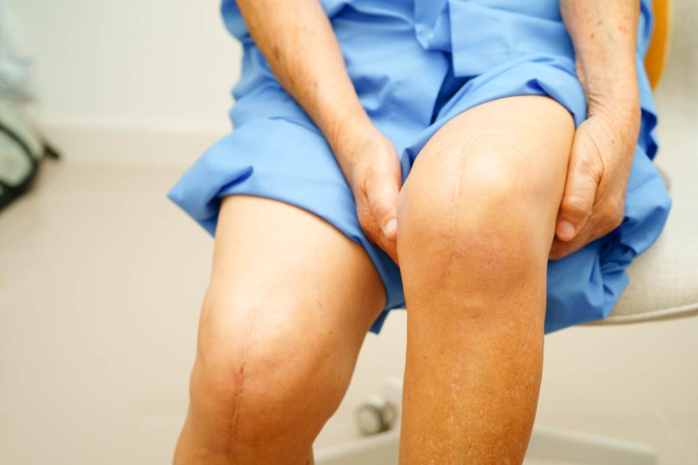 How Do Palm Beach Stem Cell Knee Injections Work?