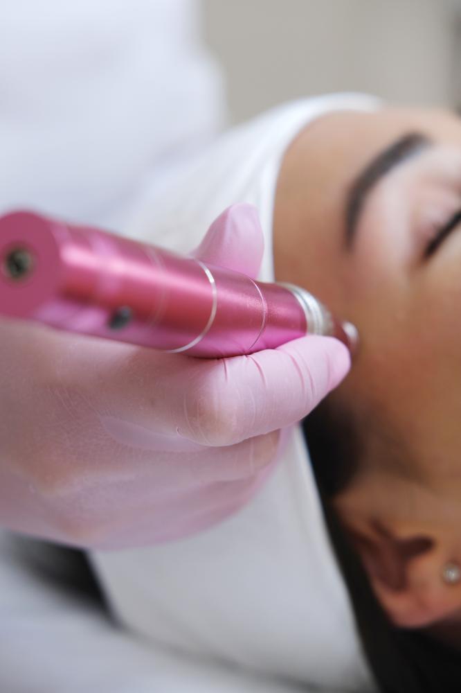 How Microneedling Works
