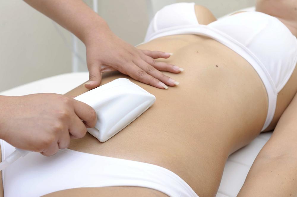 The Liposuction Experience