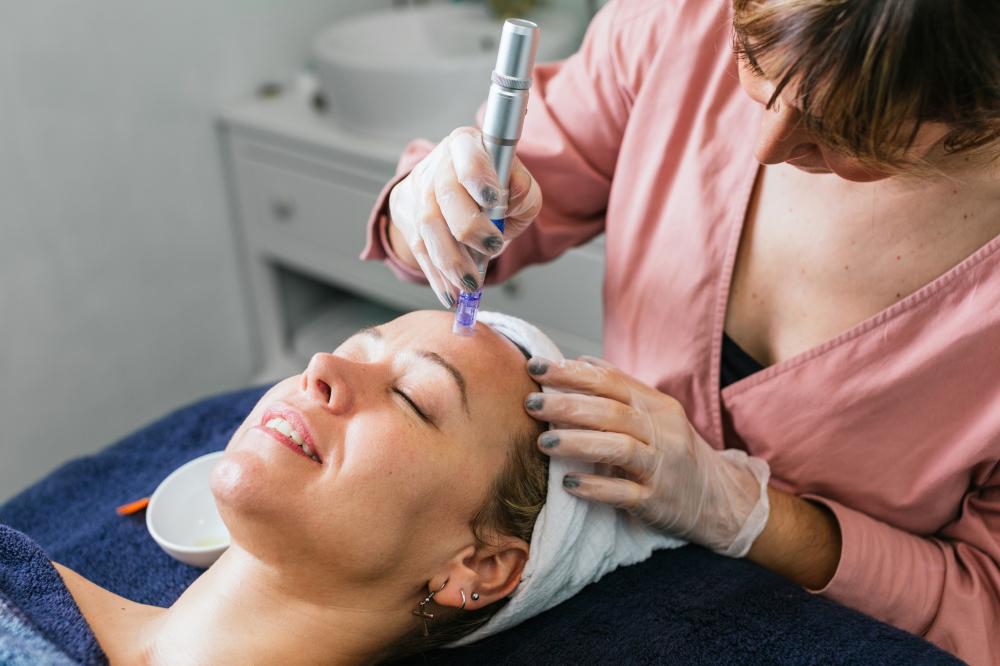 What Happens During a Microneedling Session?