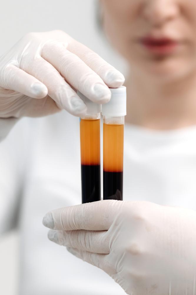 Personal Perspective: Choosing the Right Treatment