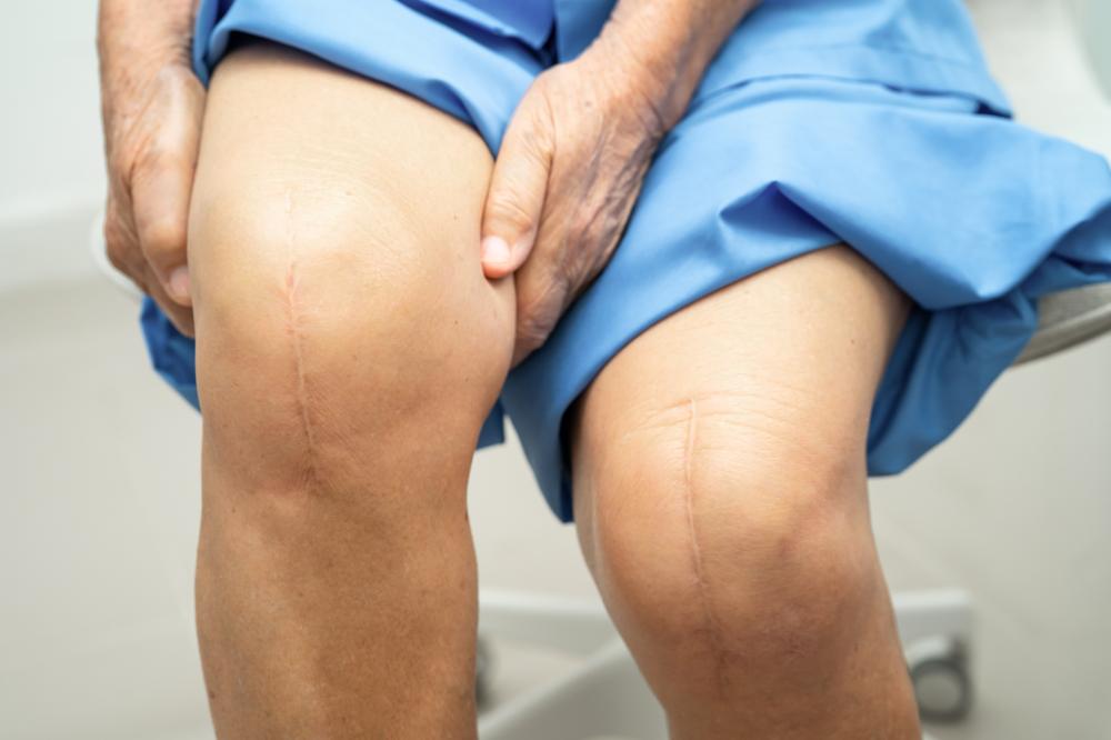 What Are the Benefits of Palm Beach Stem Cell Therapy For Knees?