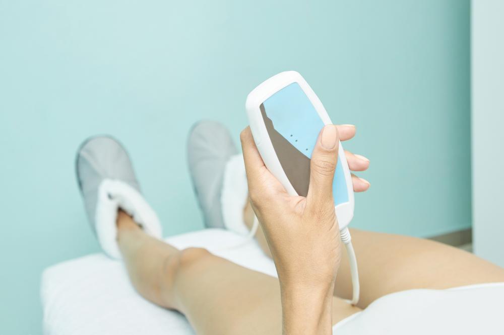 Common Causes of Spider Veins