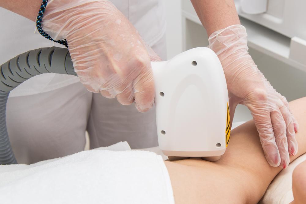 What to Expect During Laser Hair Removal?