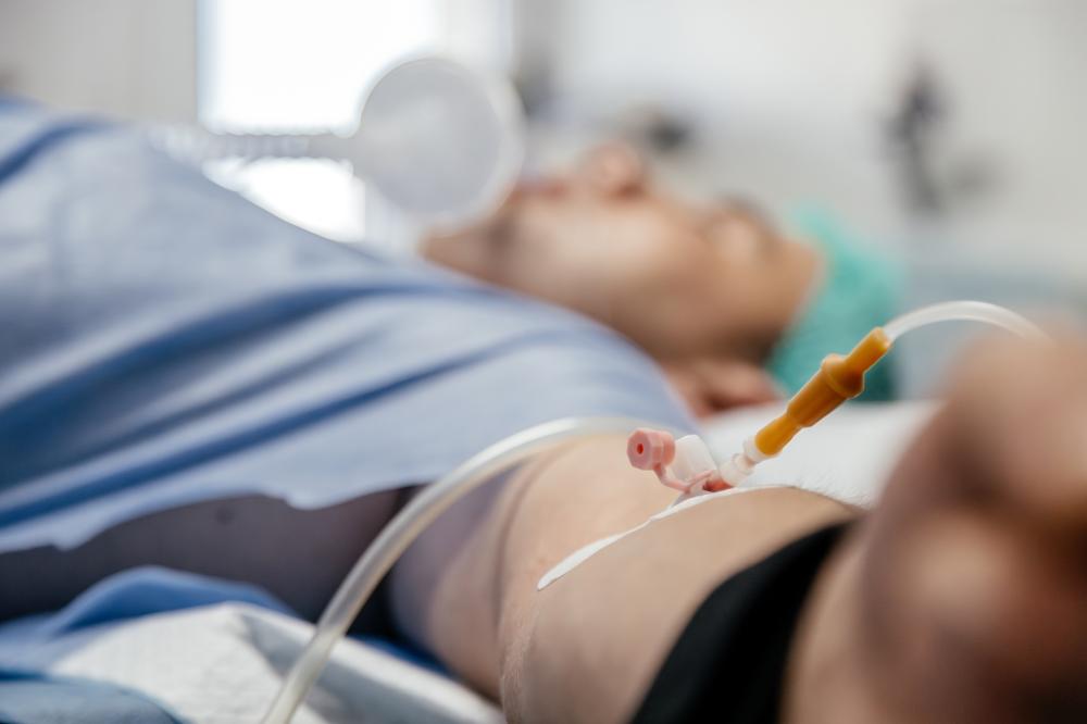 How Does Intrathecal Delivery Work?