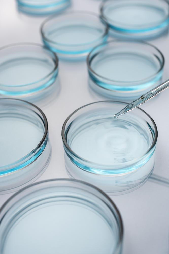 What Are the Benefits of Stem Cell Therapy San Diego Ca?