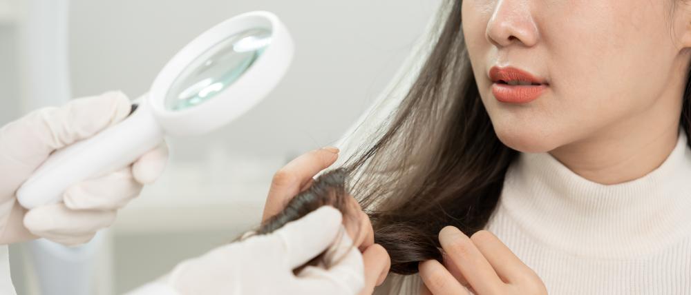 What Are Common Concerns About Hair Loss Treatment?
