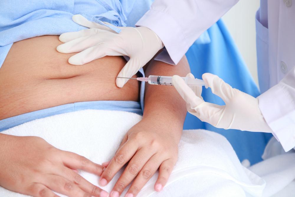 Stem Cell Injections Miami Explained