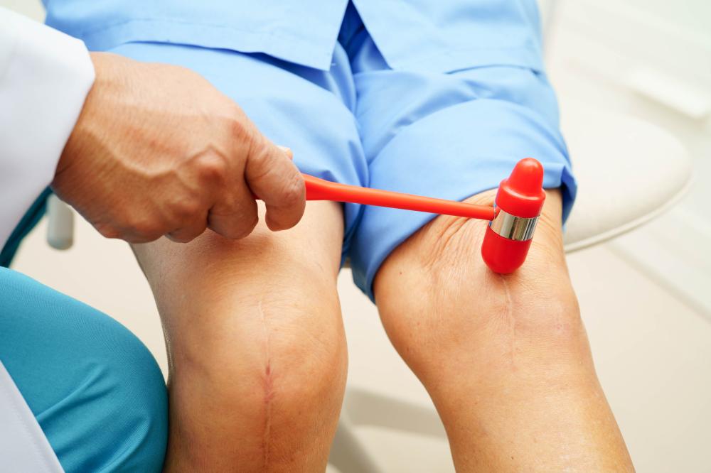 How Does Miami Stem Cell Therapy For Arthritis Work?