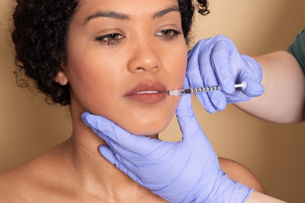 Considerations Before Getting Lip Injections