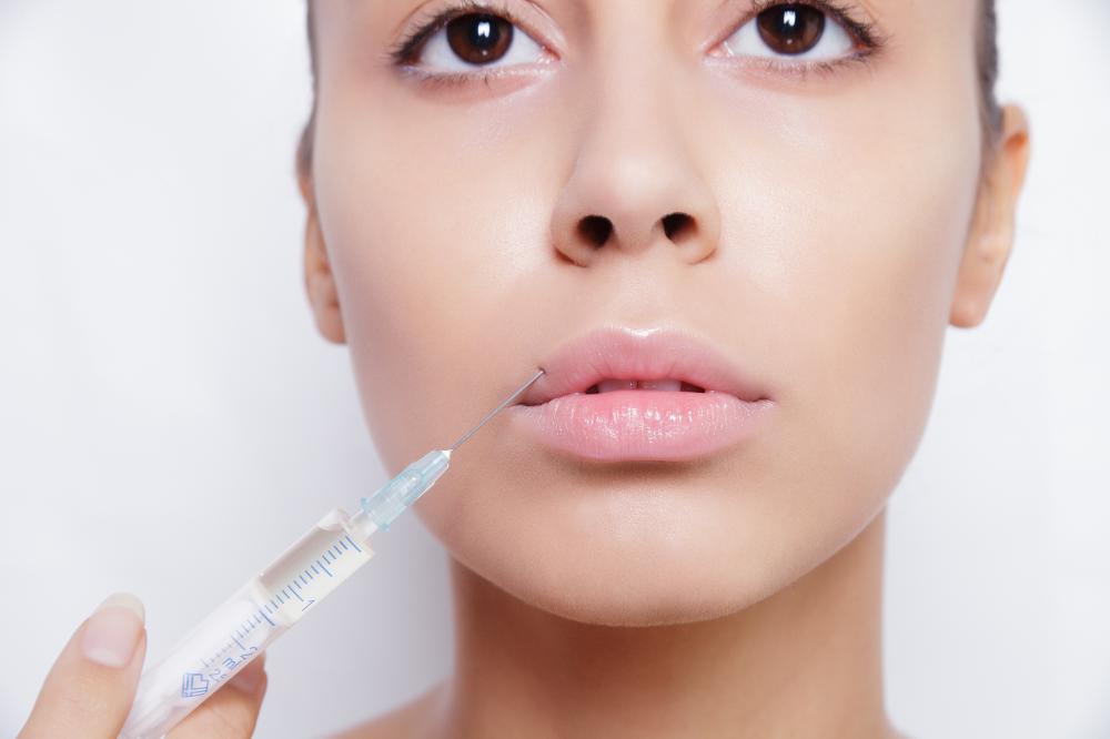 What is Juvederm?
