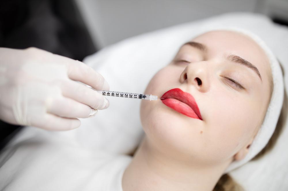 How Lip Fillers Melbourne Work