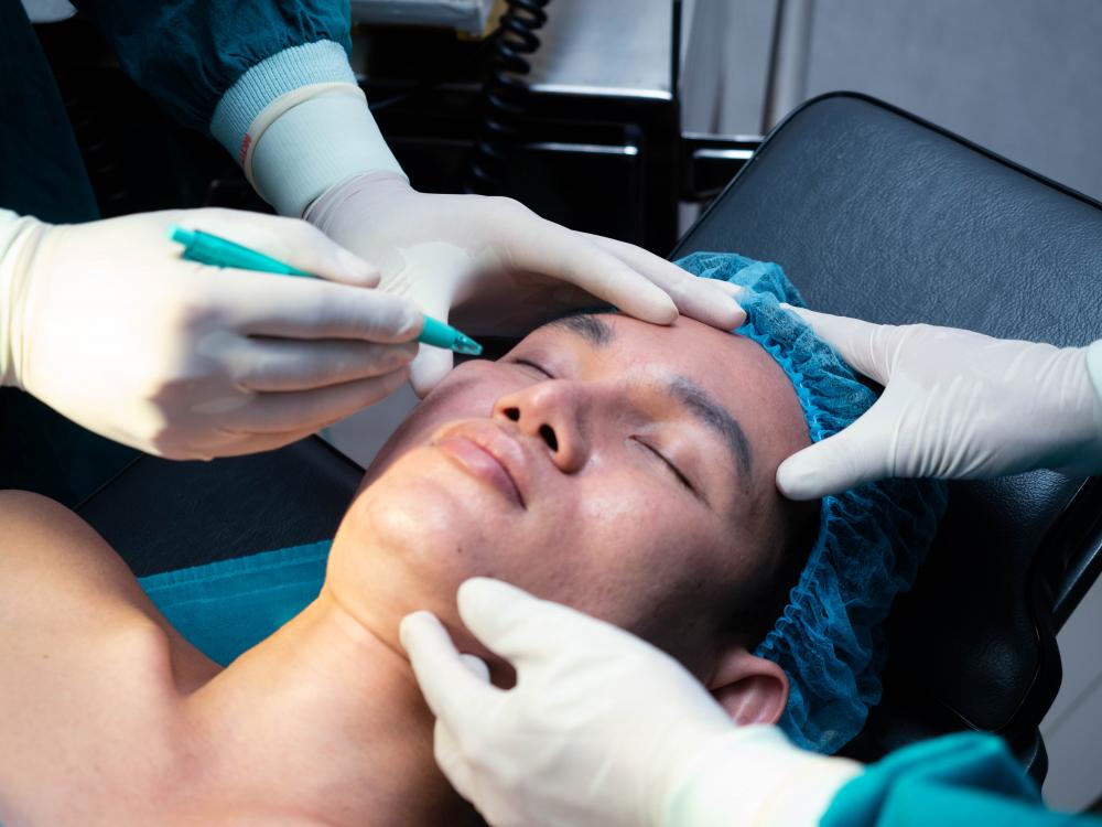 The Benefits and Considerations of Sculptra
