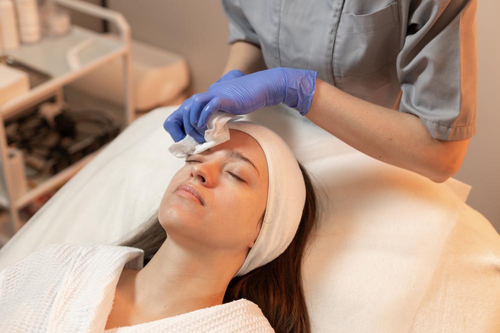 Choosing the Right Chemical Peel