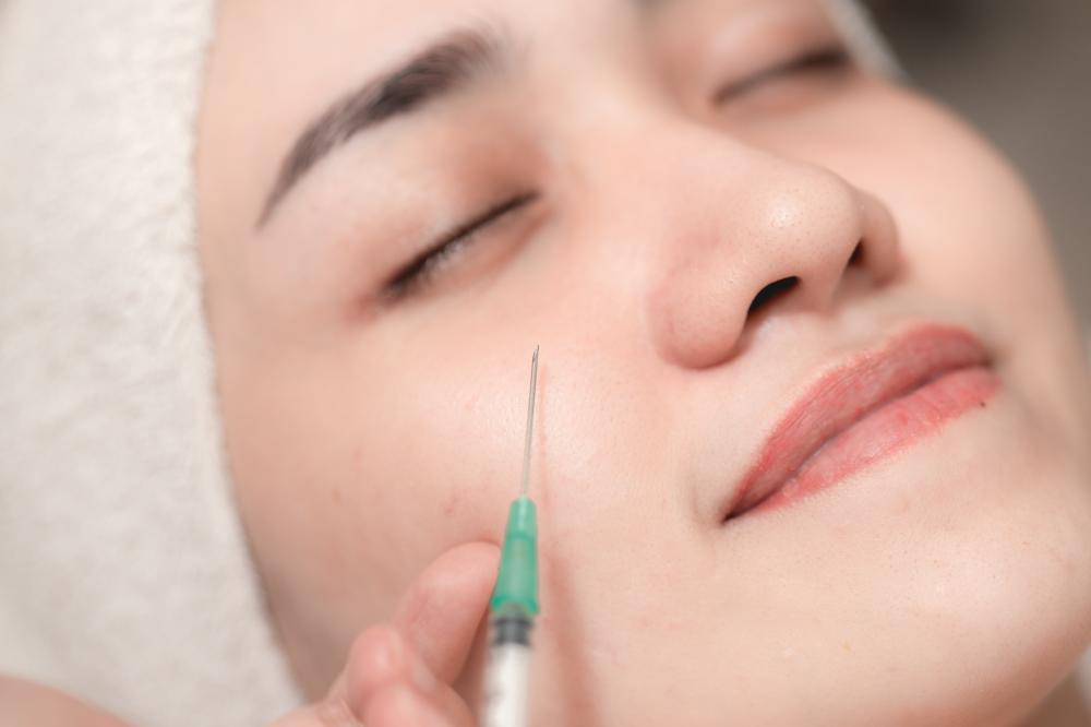 Benefits of Dermal Fillers Melbourne