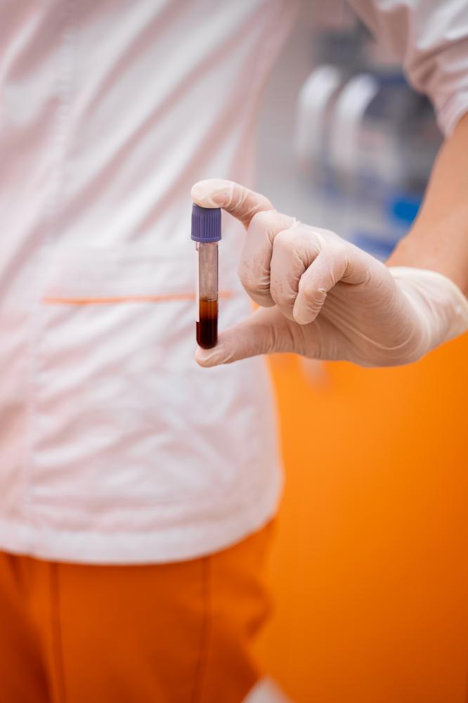 Why Do PRP and Stem Cell Cost Vary?