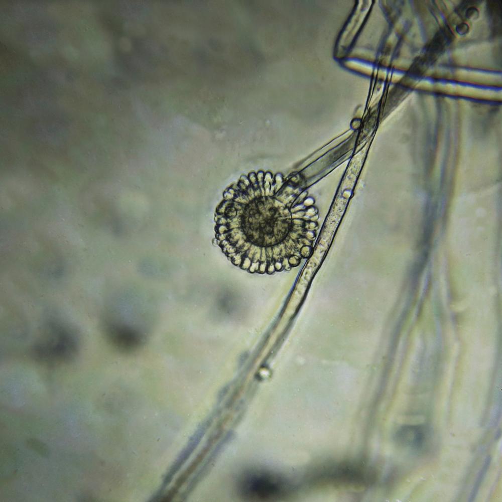 Real-World Insights on Handling Rhizopus California