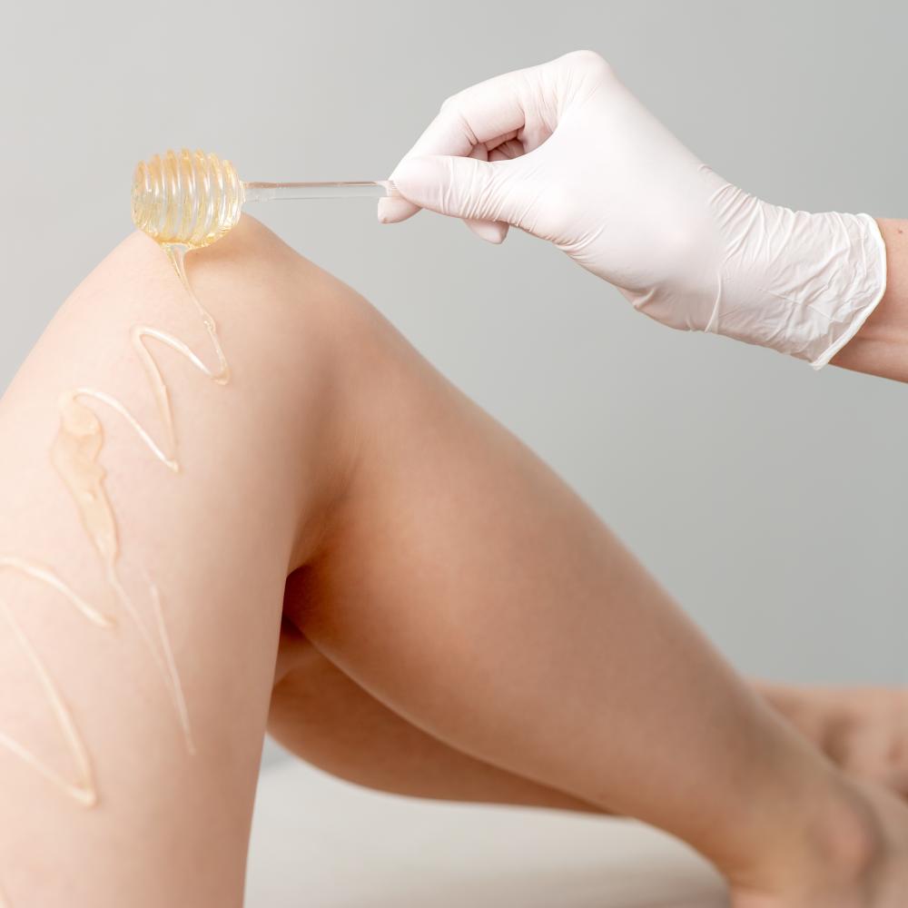 Why Consider Sclerotherapy?
