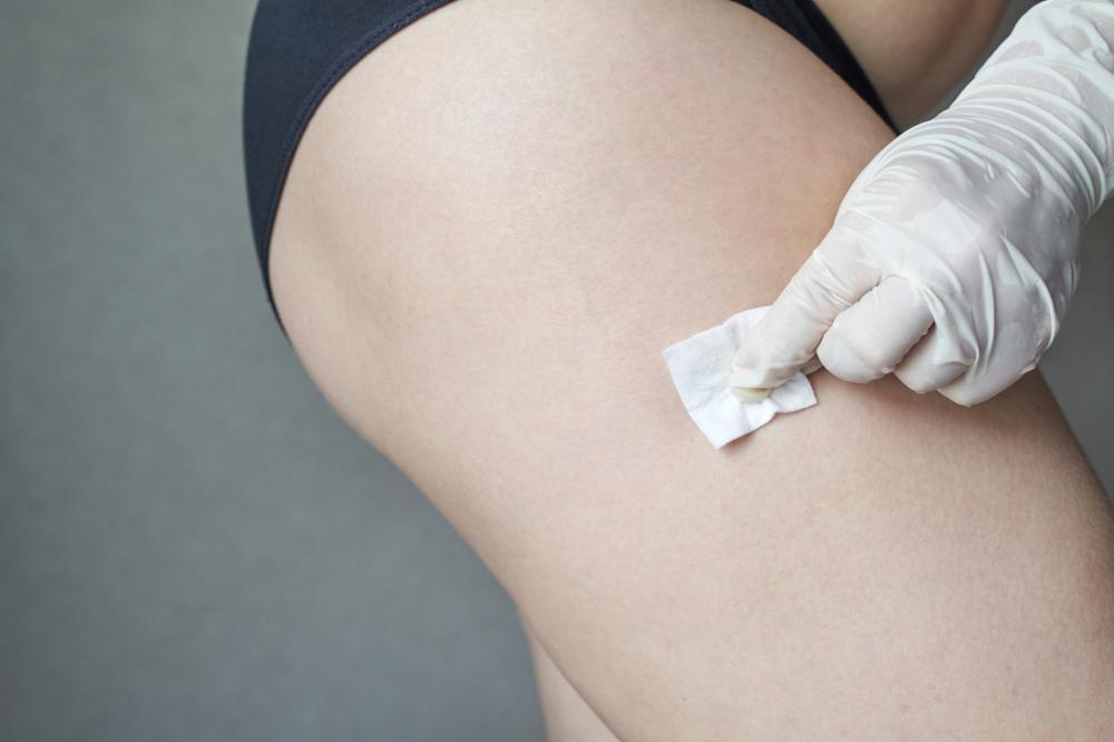 How to Apply 10 Lidocaine Numbing Cream Effectively