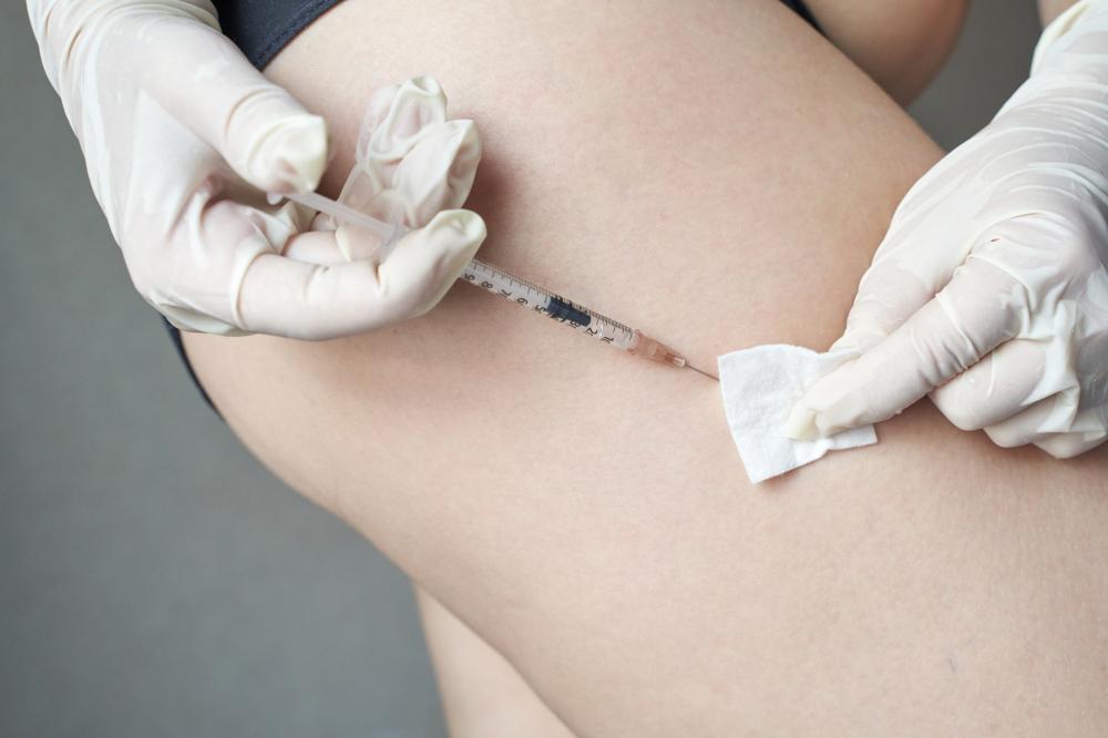 Application Techniques for Optimal Results