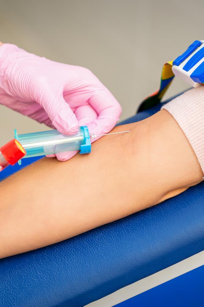 Comprehensive IV Therapy Drips for Health and Recovery
