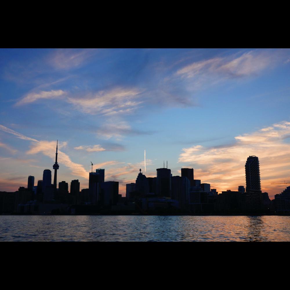 The Sculptra Butt Lift: A Premier Choice for a No Surgery Butt Lift in Toronto