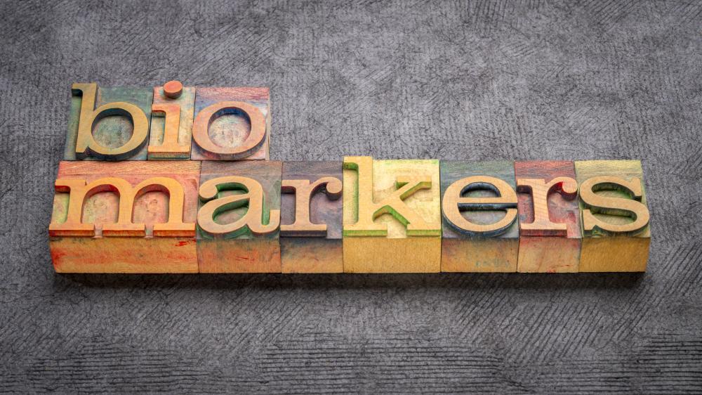 Why Do Backlinks Matter?