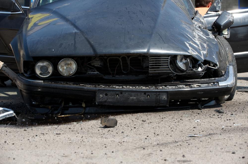 Nuestro Enfoque Único para Manejar Casos de Accidentes de Auto